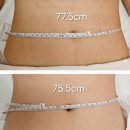 서상동131 | 팔뚝 등 셀룰라이트 제거에 탁월한 관리 리포사지 창원 서상동 중동 피부의봄