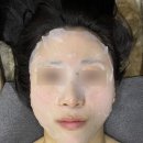 동성로 윤곽관리 병원 장비로 진행하는 올웨이브 리프팅 윤곽관리 바디관리연구소 후기