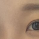 서울신세계안과의원 이미지