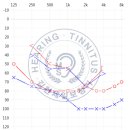 소리드림 보청기 이미지