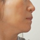 여우야 | [ 여우야/에이피뷰티 ] 에이피뷰티 실버 사용후기 ^^