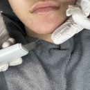 예뻐지는 | [첨단 피부관리]첨단 예뻐지는샵 스킨플래닝 후기 각질+잔털 제거효과