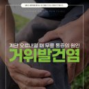 희망가득마취통증의학과의원 | 운천역정형외과 무릎 통증, 거위발건염 의심해야