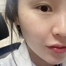 올로케어