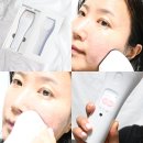 (주)린뷰티 | 뷰티디바이스 린커브 홈케어 윤곽관리 9주 사용후기