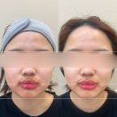 아이섭 이미지