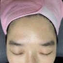 썬헤어라인 이미지