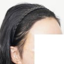 바람부는날에도 성형외과의원 네이버블로그