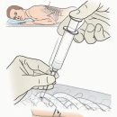 늑간