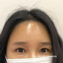 복주는눈썹 이미지