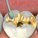 가까운치과기공소 이미지