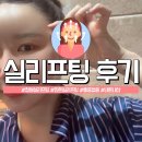 민트 | 창원피부과 민트실리프팅 내돈내산 추천 후기