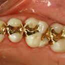 가야치과기공소 이미지