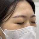 구마브로우 | 대구 눈썹문신 잔흔제거 1-3회차 변화 (친구 구경한 후기)