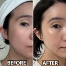 수동약국 | 약국 입점 식스킨 오토 MTS 타이트샷 나노니들 후기｜모공·피부결 홈케어 뷰티 디바이스 추천