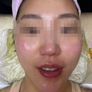 피부나라 - 노원구 | 안산 깨끗한피부나라 꿀광케어 후기, 달라진 피부결 피부톤!!:)