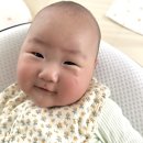 [이용후기]4개월 아기 밀크커피 반점 치료 후기 / 세종 퍼스트피부과