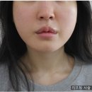 강남연세라인의원 네이버블로그