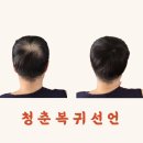 365부분 이미지