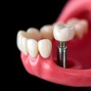 덴토피아치과의원 이미지