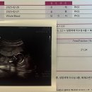 홍산부인과의원 네이버블로그