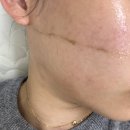 두산사우나 | 수성구 스킨플래닝 전문 뽐온뷰티 두산점