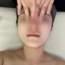 봄봄에스떼 | 용인윤곽관리 봄봄에스떼 방문 후기🤍 작은 얼굴 만들기