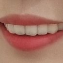 애프터기공소 이미지