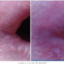 아주고운피부과의원 이미지