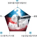 김포시 임플란트 전문치과 소개 5곳 (오스템)