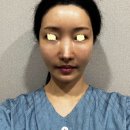 괜찮아바비 | 마지막으로 하길 잘했다❗️신의손 윤곽계 에르메스 윤곽재수술 후기🎉