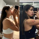 보라손세차 | [일상]피부과 시술 후기를 곁들인 일상