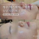 청주 | 에스테틱 동남지구 피부관리 슈퍼젝션 예소뷰티 후기