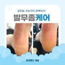 앤드홈케어 - 안산시 상록구 해양5로 11 | 발무좀인 줄 알았는데? 굳은살·티눈까지 함께 관리한 프리앤드 발 케어 후기