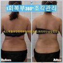 설화미