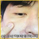 울산민내과의원 | 울산 일요일 대상포진 진료 가능 내과 : 이영암 내과의원