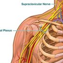 A schwannoma(neurilemmoma) in the neck ^^ 이미지