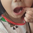 우리이웃치과의원 | 오창어린이치과의원 생애첫치과방문 웃음가스 신경치료 후기