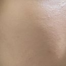 조이피부과의원 이미지