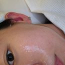 성동구 성수 피부관리 트리버에스테틱 여드름관리 후기