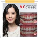 수치과병원 이미지