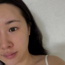 즐거운온누리약국 | 셀트리온 지피덤 EGF 맥스 베리어 리페어 크림 사용후기,약국 피부장벽크림 추천