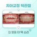 연세미소라인치과교정과치과의원 | 치아교정 턱관절 입 벌릴 때 딱 소리 나는분들을 위한 교정 가이드