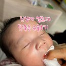 민소아과의원 | 신생아 설소대 단축증 수술후기 24.04.08