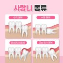 사랑니랑구강악안면외과 치과의원 네이버블로그