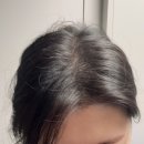 충청B/R어린이집 | 닥터모락 김포풍무점 검단 탈모 두피관리 솔직후기