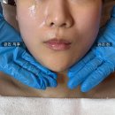 퍼스트 더 라움 에스테틱 | 송도 퍼스트월드 피부관리 더끌림스킨 송도에스테틱 리얼 후기 정리