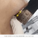 광교턱관절? 2가지 모르면 병원 가도 더 아픕니다 [전문의 조언]
