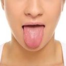 서울테라치과 이미지