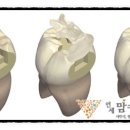 철원치과기공소 네이버블로그